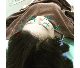 半信半疑でしたが 博多区YM様